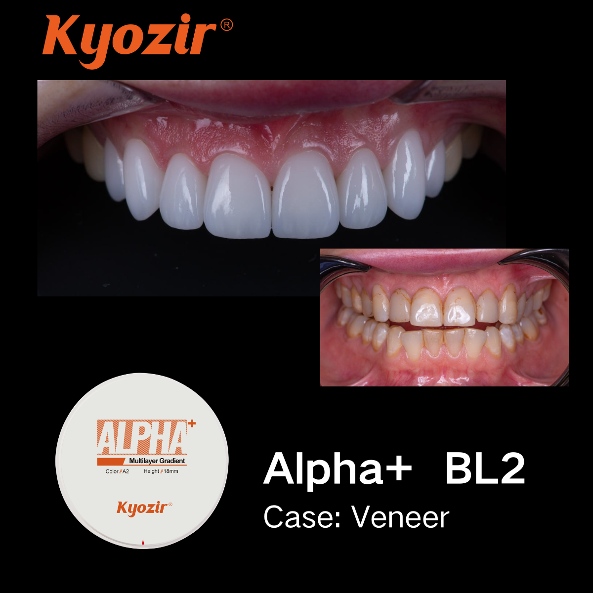 Dental Zirconia Block factory - Zirconia Disc manufacturer from China